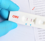 בדיקת cmv - תמונת אווירה